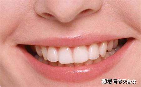 整牙会带来 整容式 的效果吗 牙齿矫正到底能达到什么效果