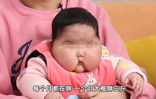 女婴1个月胖3斤,发育停滞 多毛 满月脸,罪魁祸首是婴儿霜