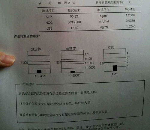 孕期独自去医院做孕检,孕妈们要注意3点,减少不必要的麻烦