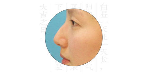 深度解析鼻子类型,测试你属于哪种鼻子