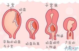 分娩后都会阴道出血,但是怎样才算是正常出血呢