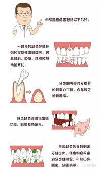 口腔常识手册之 牙齿缺失 