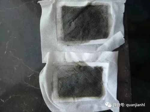 小小的水肿,背后的机理却并不简单 来帮你 搜狐母婴 搜狐网 