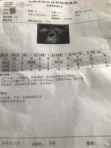 我想问孕囊看男女真的准吗 生日2018年01月宝宝圈 