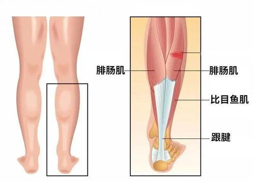 讲真 上热搜被3亿人围观的 小腿肌肉阻隔术 是啥 为啥不建议做