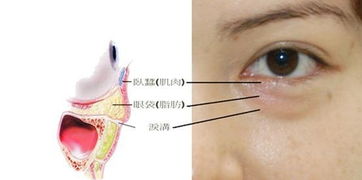 眼袋附近肌肉频繁跳动是什么原因 