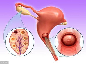 原创备孕饮食原则有哪些？卵巢早衰、卵泡小、内膜薄备孕的女性快学