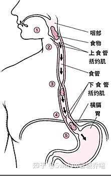 巧解 胃食管反流 胃炎 