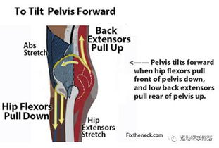 骨盆前倾可以这样自我矫正练习