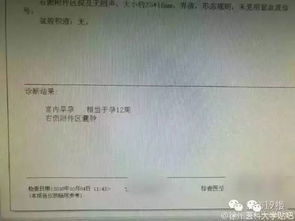 丧心病狂 12岁女童被拐怀孕,产检医生报警后,陪同男子扬言要炸了医院