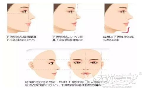 垫下巴选哪种材料比较好 术后多年假体会不会出现移位