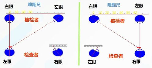 想问下瞳距仪准还是瞳距尺准 